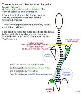 sciatic pain diagram