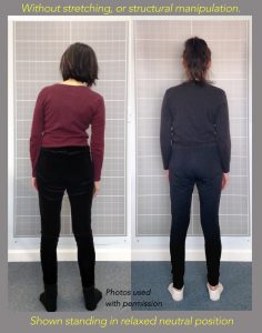 P,before after posture inspire somatics