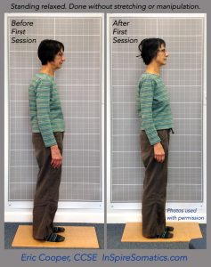 Red-Light posture pattern before and after